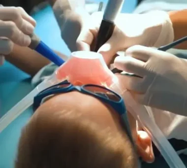 immagine.video.sedazione.cosciente bambino sottoposto alla sedazione cosciente nello studio dentistico